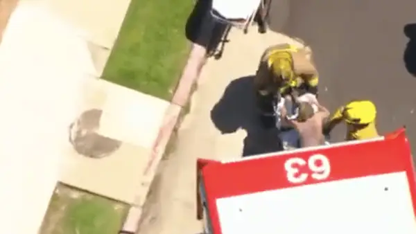 Anne tornou -o muito queimado no fogo depois de cair em 2 los no carro