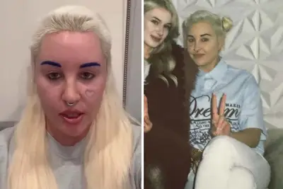 Amanda Bynes foi para a tatuagem de seu rosto depois de apresentar sua nova visão de seu podcast: ela não deveria se preocupar com isso